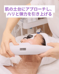 OPL施術