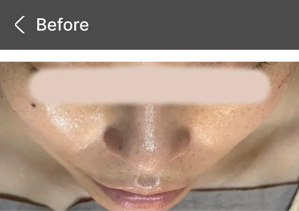 【Before】