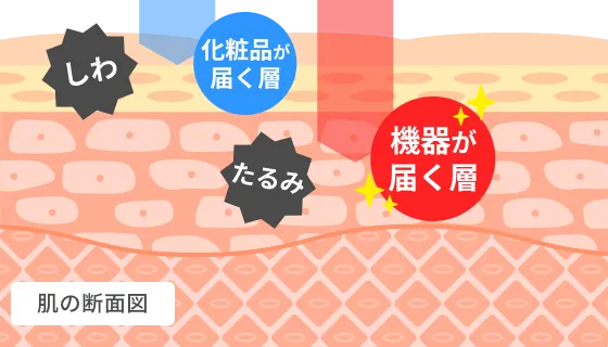 化粧品が届く層と機器が届く層を表現したイラスト
